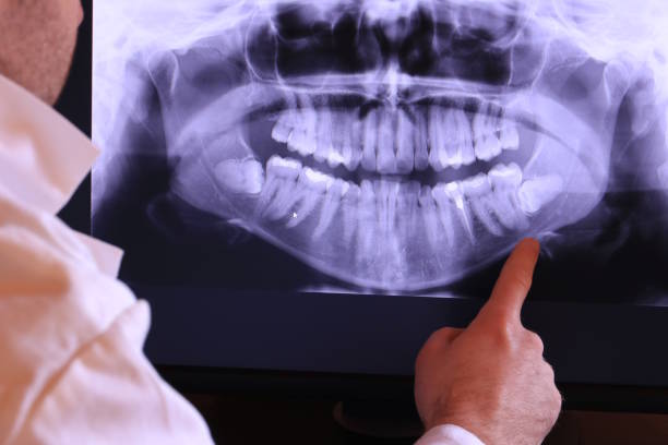Best Emergency Dentist for Lost Fillings or Crowns in Farmer City, IL