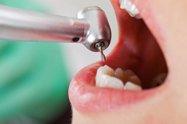 Best Emergency Cosmetic Dentistry in Farmer City, IL